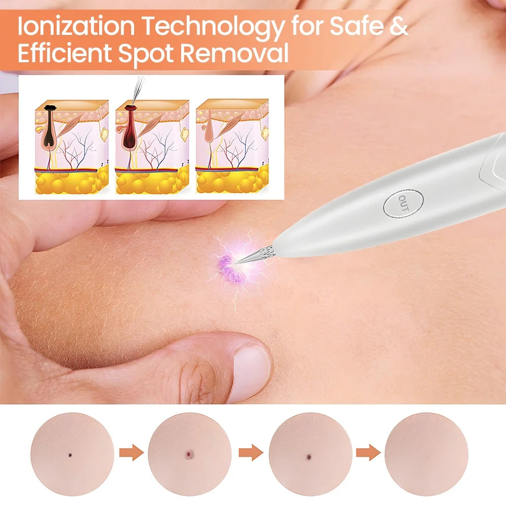 Laser Plasma Pen Tattoo Remover Skin Pore Care Corn Dark Tag Nevus Pimple Spot Cleaner Beauty Tools