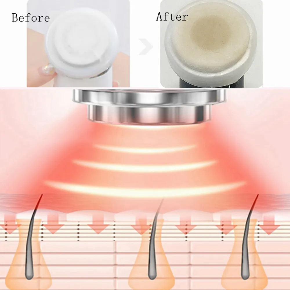 Mesotherapy Face Massager - Yolee Glow