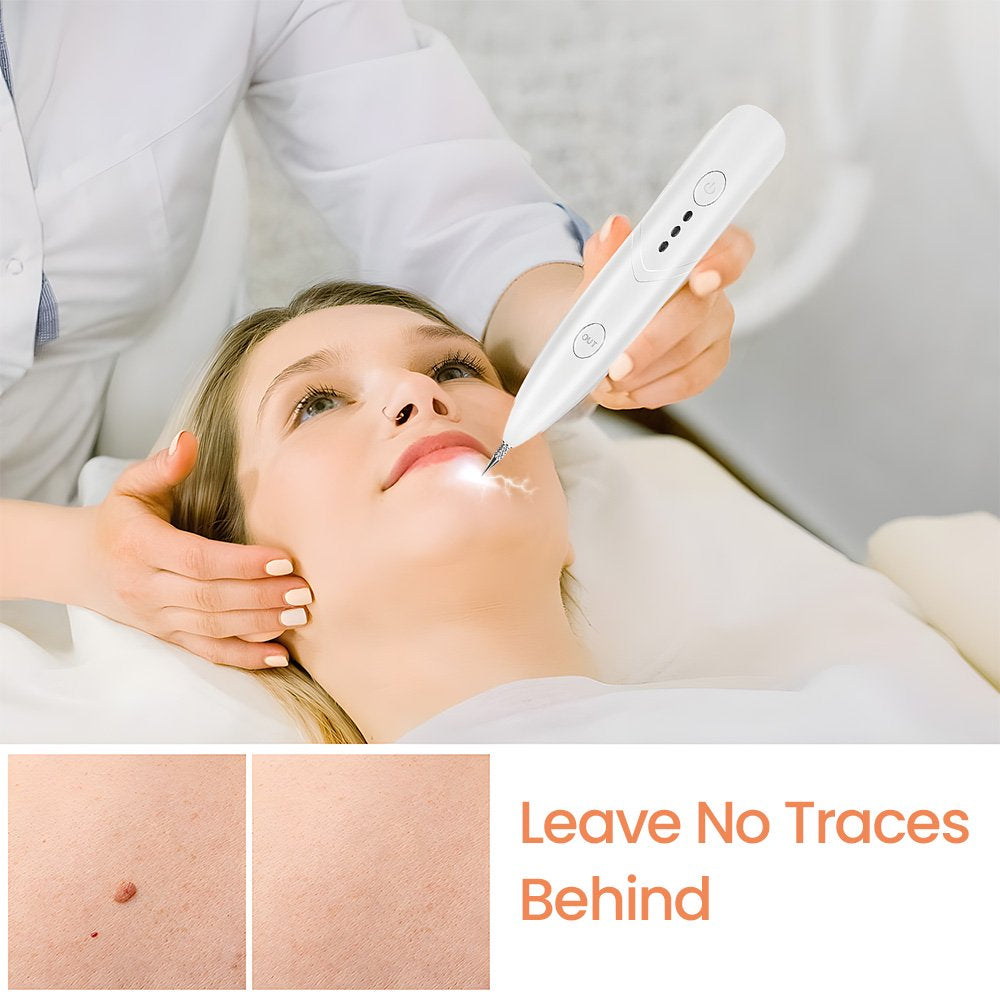 Laser Plasma Pen Tattoo Remover Skin Pore Care Corn Dark Tag Nevus Pimple Spot Cleaner Beauty Tools