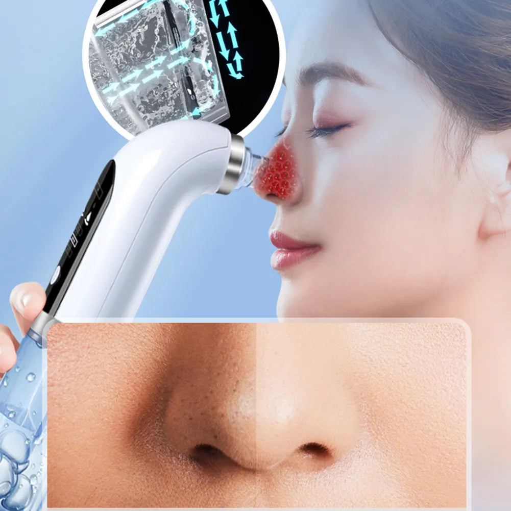 Bubble Blackhead Remover - Yolee Glow