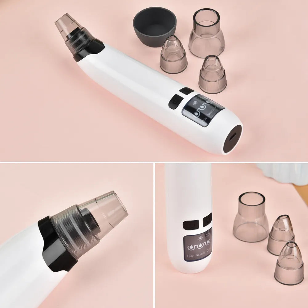 Electric Pore Cleaner Vacuum - Yolee Glow