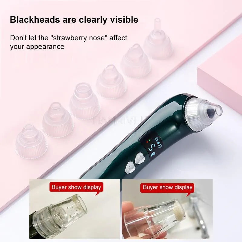 Heating Blackhead Suction - Yolee Glow