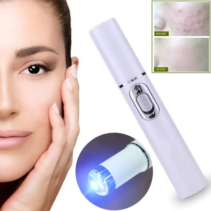 Blue Light Facial Therapy Pen - Yolee Glow