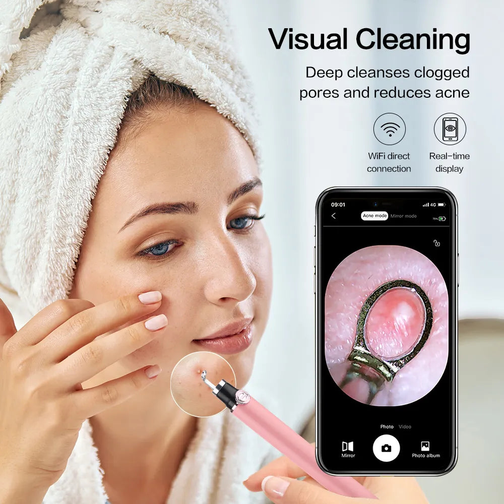 Visual Ance Cleanser