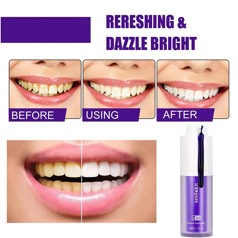 Advanced Whitening Purple Toothpaste Kit